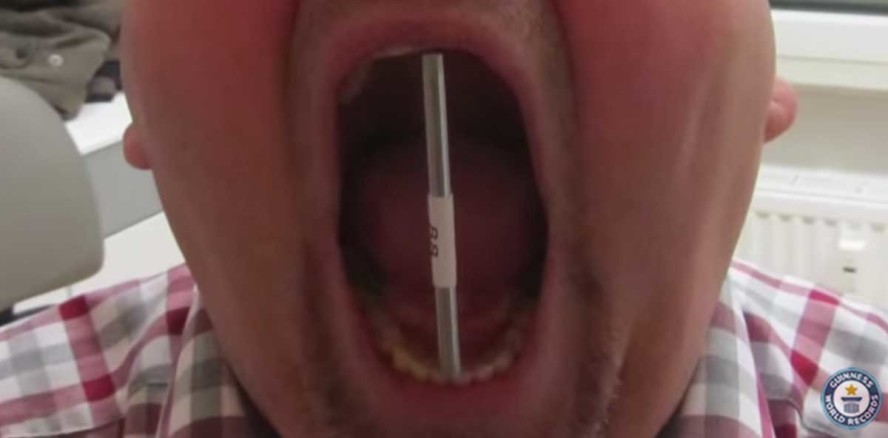 Dieser Schwabe hat die größte Klappe der Welt