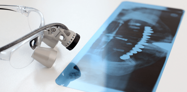 Immer weniger Implantate in der Schweiz?