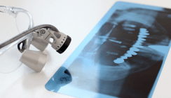 Immer weniger Implantate in der Schweiz?
