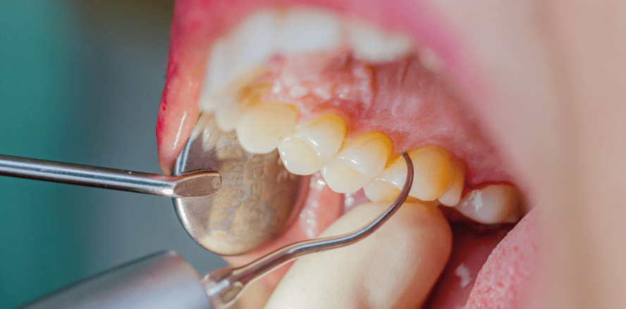 Dank modernem Werkzeug wettbewerbsfähig bleiben