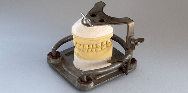 Wie viel Okklusion braucht der Mensch?