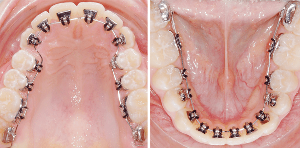 „Kieferorthopäden kaufen nur das, was in ihren Händen funktioniert“