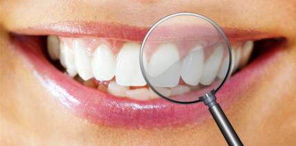 wingbrush: Student gründet Start-up mit neuer Interdentalbürste