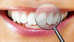 wingbrush: Student gründet Start-up mit neuer Interdentalbürste