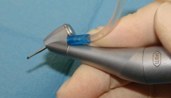 Vereinigung von Hand- und Winkelstück