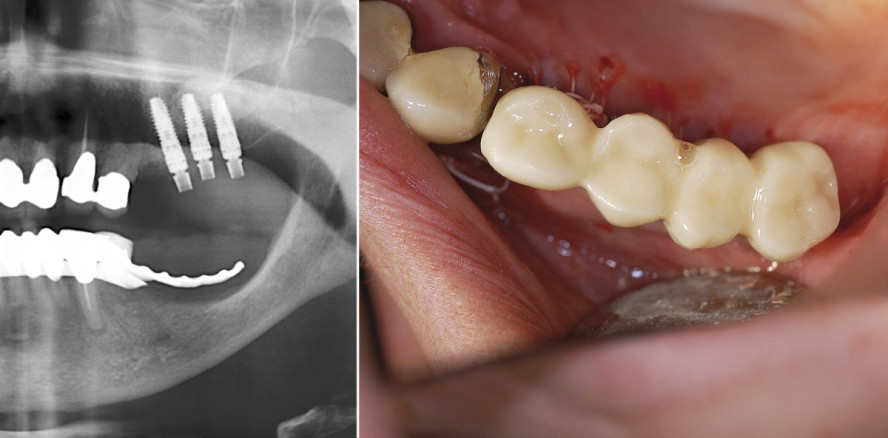 Integrierter Workflow für die Sofortversorgung