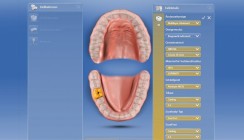 Digitaler Workflow nach Implantatfreilegung