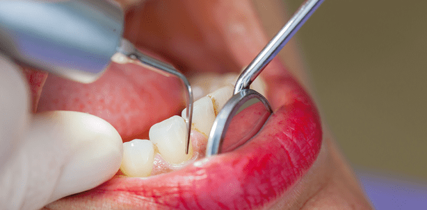 PROFI-laxe mit System – Durchdachtes Konzept, professionelle Ausstattung