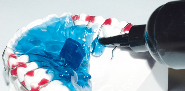 Wunschkunststoff für Wunschzahnspangen