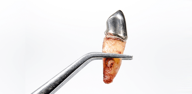 Die Wurzel allen Übels?