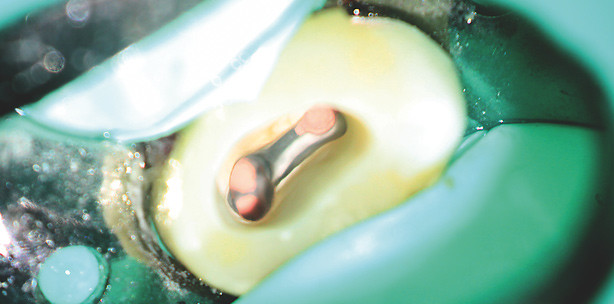 Die Tücken in der Wurzel