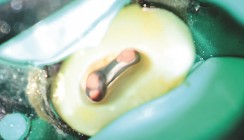 Die Tücken in der Wurzel