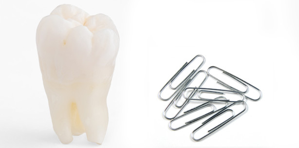 Pfusch an der Wurzel: Zahnarzt operiert mit Büroklammern