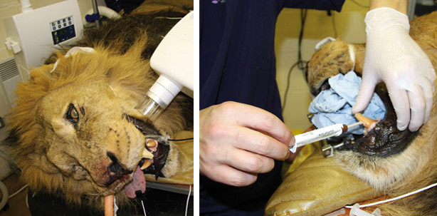 Neun Zentimeter langer Wurzelkanal