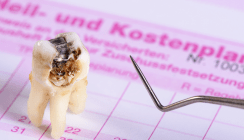 Wirtschaft und Stress Schuld an schlechten Wurzelfüllungen?