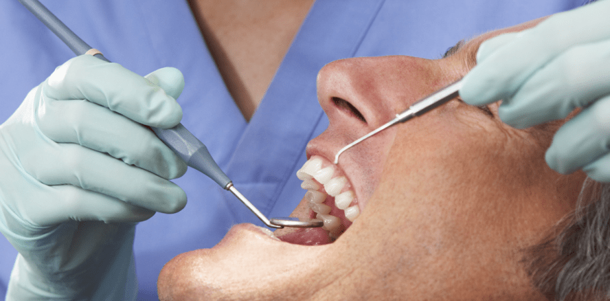 Zwei Wochen lang die Zähne nicht geputzt: Ein Selbstversuch