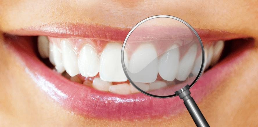 Die weltweit erste elektrische Zahnbürste mit Durchblick