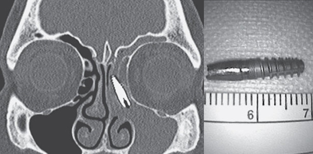 Dieser Schnupfen hatte es in sich...