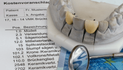 Zahnbehandlungen stellen oft große finanzielle Belastung dar