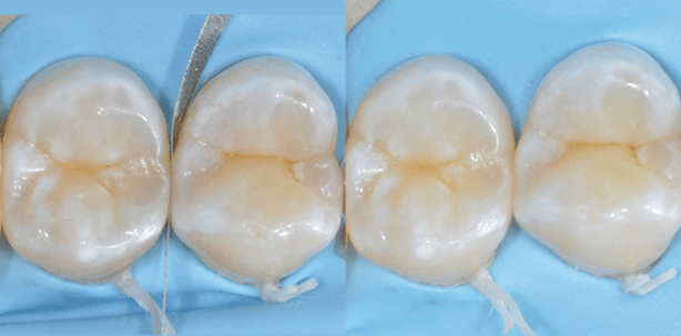 Der Zahnarzt ist ein Dienstleister und kein Künstler
