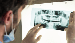 Die postendodontische Erkrankung und die Bedeutung der DVT