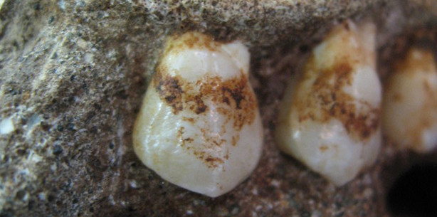 Pflanzenreste in zwei Millionen Jahre altem Zahnbelag entdeckt