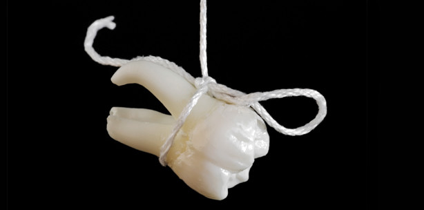 Zahnerhalt ist immer auch ­psychologischer Halt