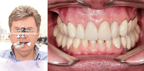 Vorgehen bei der Rehabilitation von Funktion und Ästhetik