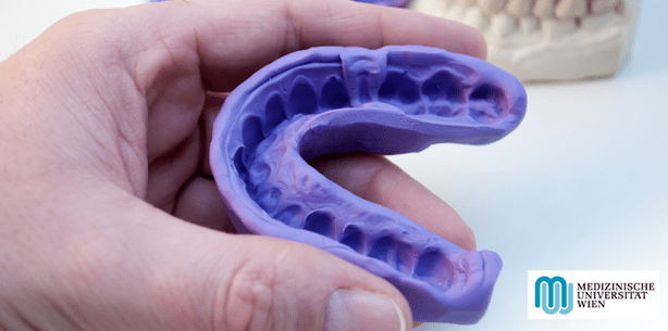 Mit High-Tech zum perfekten, digital gefertigten Zahnersatz