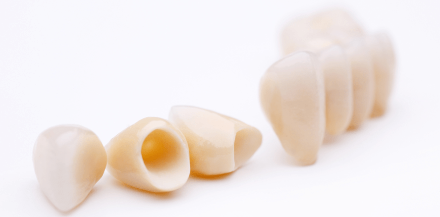 Erfolgreicher Abschluss der Punktwert-Verhandlungen für Zahnersatz