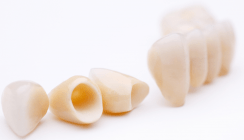 Erfolgreicher Abschluss der Punktwert-Verhandlungen für Zahnersatz