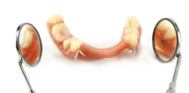 Kein Schadensersatz für verschwundenes Gebiss