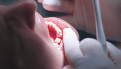 Hormonelle Einflüsse auf Gingiva und Parodontium