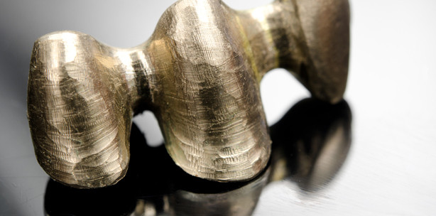 Pfusch im Kindermund: Vierjährige erhält lauter Silberkronen