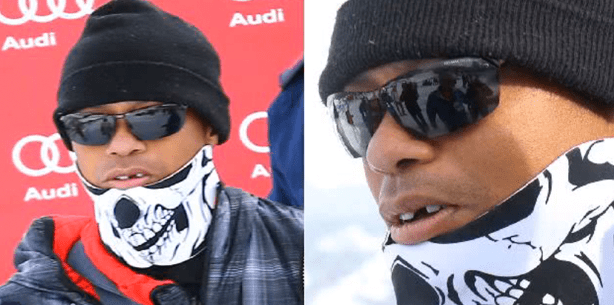 Ausgeknockt: Tiger Woods büßt Frontzahn ein