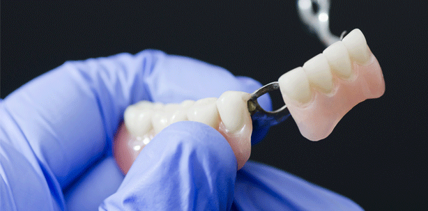 Interimsbrücken zu früh eingebracht: Grober Behandlungsfehler