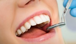 Professionelle Zahnreinigung: Wichtiger Baustein der Vorsorge