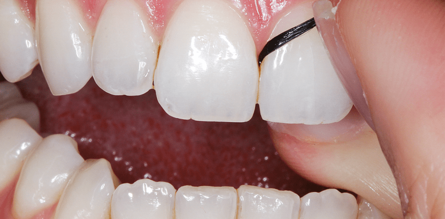 Das Einmaleins der häuslichen Mundhygiene