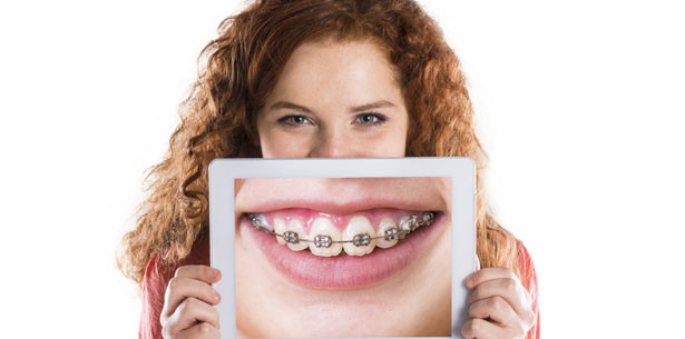 Raucher sollen Zahnspangen finanzieren