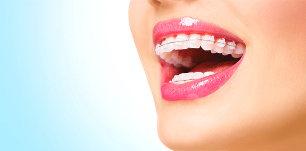 Für Gebiss-Korrekturen ist man nie zu alt