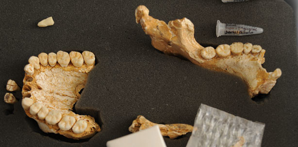 Zahnstein enthüllt: Schon Neandertaler nutzten Heilpflanzen