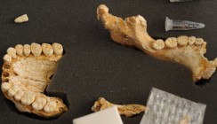 Zahnstein enthüllt: Schon Neandertaler nutzten Heilpflanzen