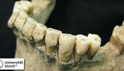 Mikrobiologisches Pompeji im Zahnstein