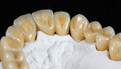 Teamwork und Ästhetik dank digitaler und analoger Technik