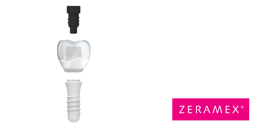 Restaurationen für ZERAMEX® P6 digital gestalten