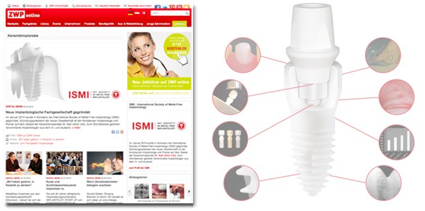 Neues ZWP-Thema „Keramikimplantate“