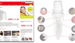 Neues ZWP-Thema „Keramikimplantate“