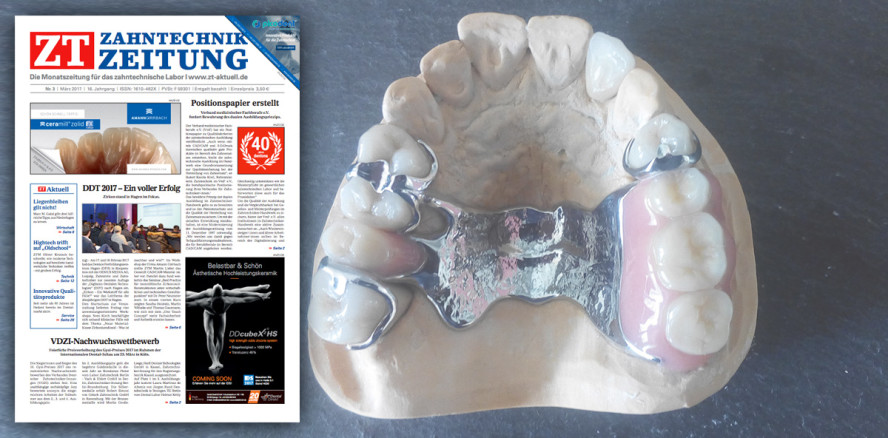 Märzausgabe der Zahntechnik Zeitung jetzt als ePaper lesen