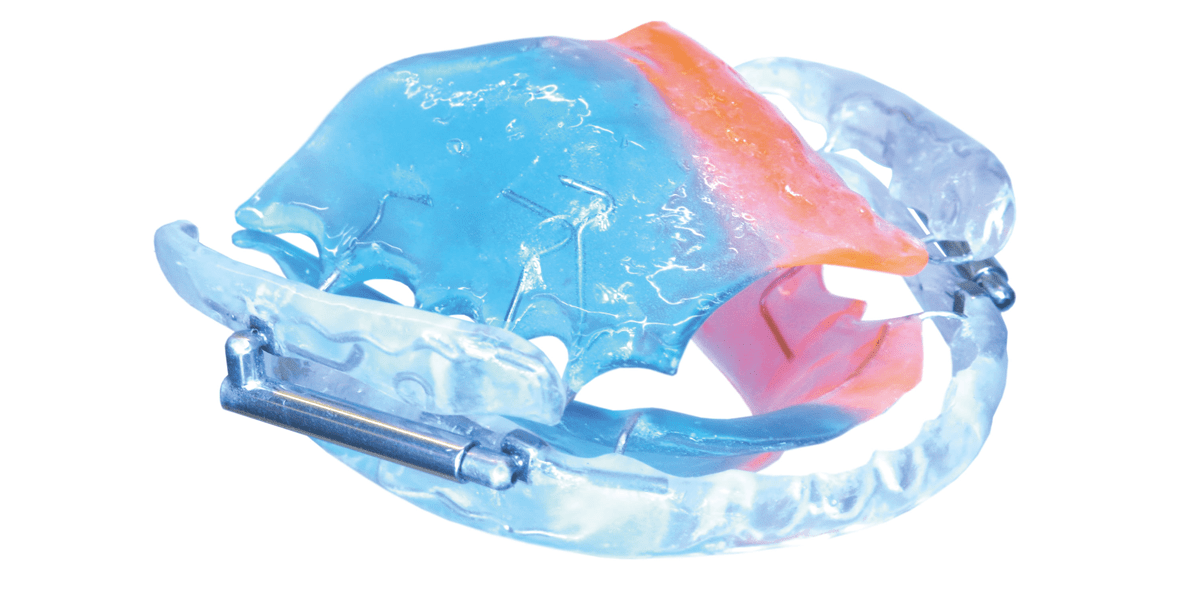 Labortechnische Fertigung der BioBiteCorrector Sleep Appliance