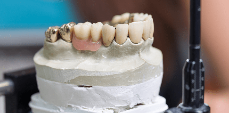 Gysi-Preis 2017 – Unabhängige Jury kürt Sieger